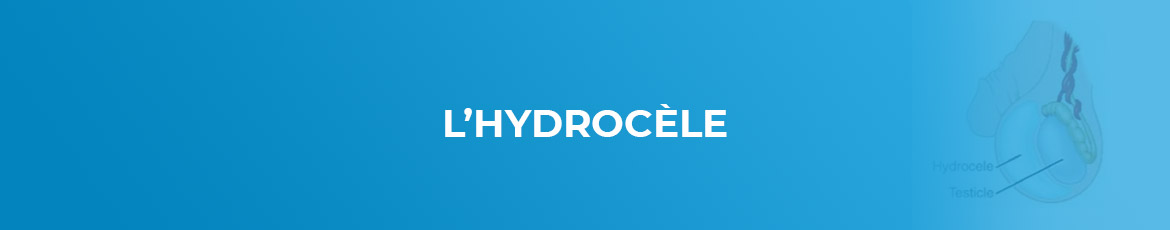 L'hydrocèle